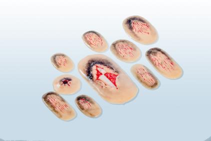 創(chuàng  )傷評估模塊